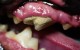 dental1