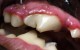 dental2